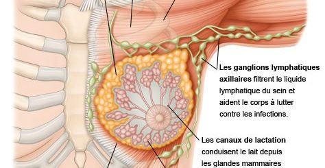 Cancer du sein: Causes, Symptômes et Traitement Naturel du Cancer du sein