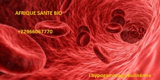 l'hypogammaglobulinémie