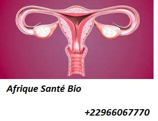 Cancer du col de l’utérus: Causes, symptômes et Traitement Naturel