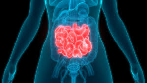 Comment se soigne le cancer de l'intestin ?