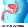 Cancer de la Prostate Traitement Naturel Cancer Prostate