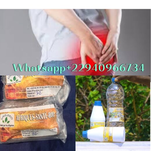 Comment soigner naturellement les hemorroïdes externes?